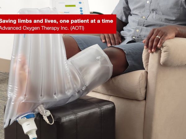 Zachęcamy do obejrzenia filmiku o MIEJSCOWEJ TERAPII TLENEM (TWO2)